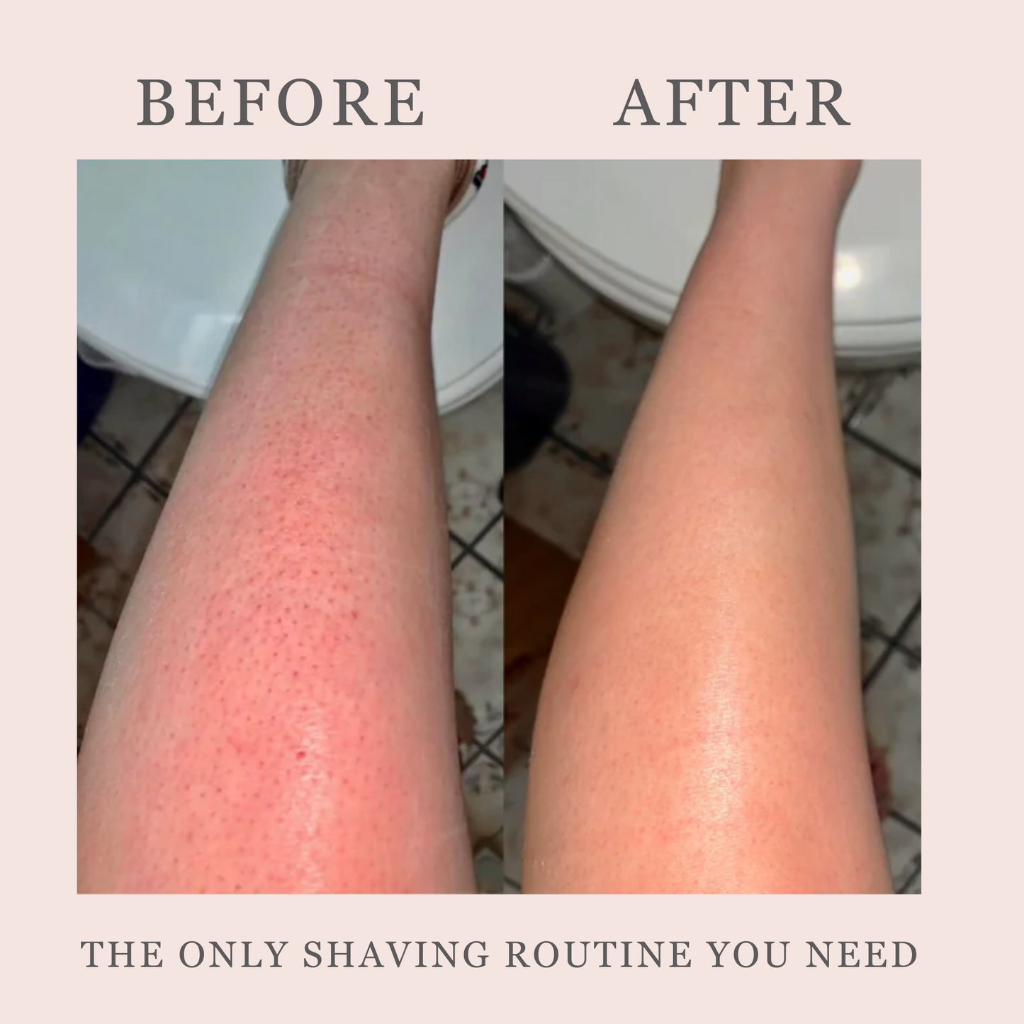 Hair Removal Routine