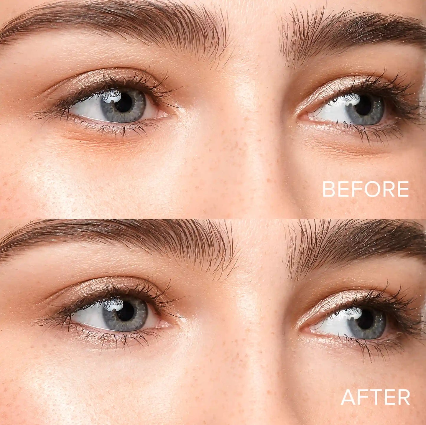Eye Patches for Puffy Eyes