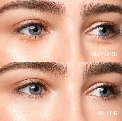 Eye Patches for Puffy Eyes
